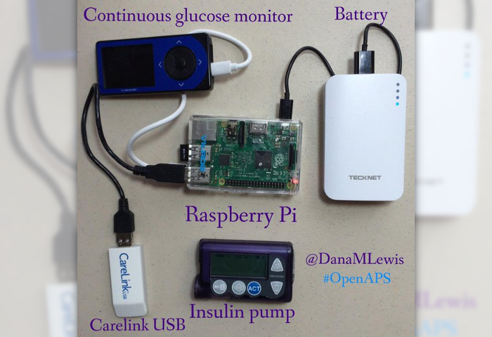 DIY Pancreas