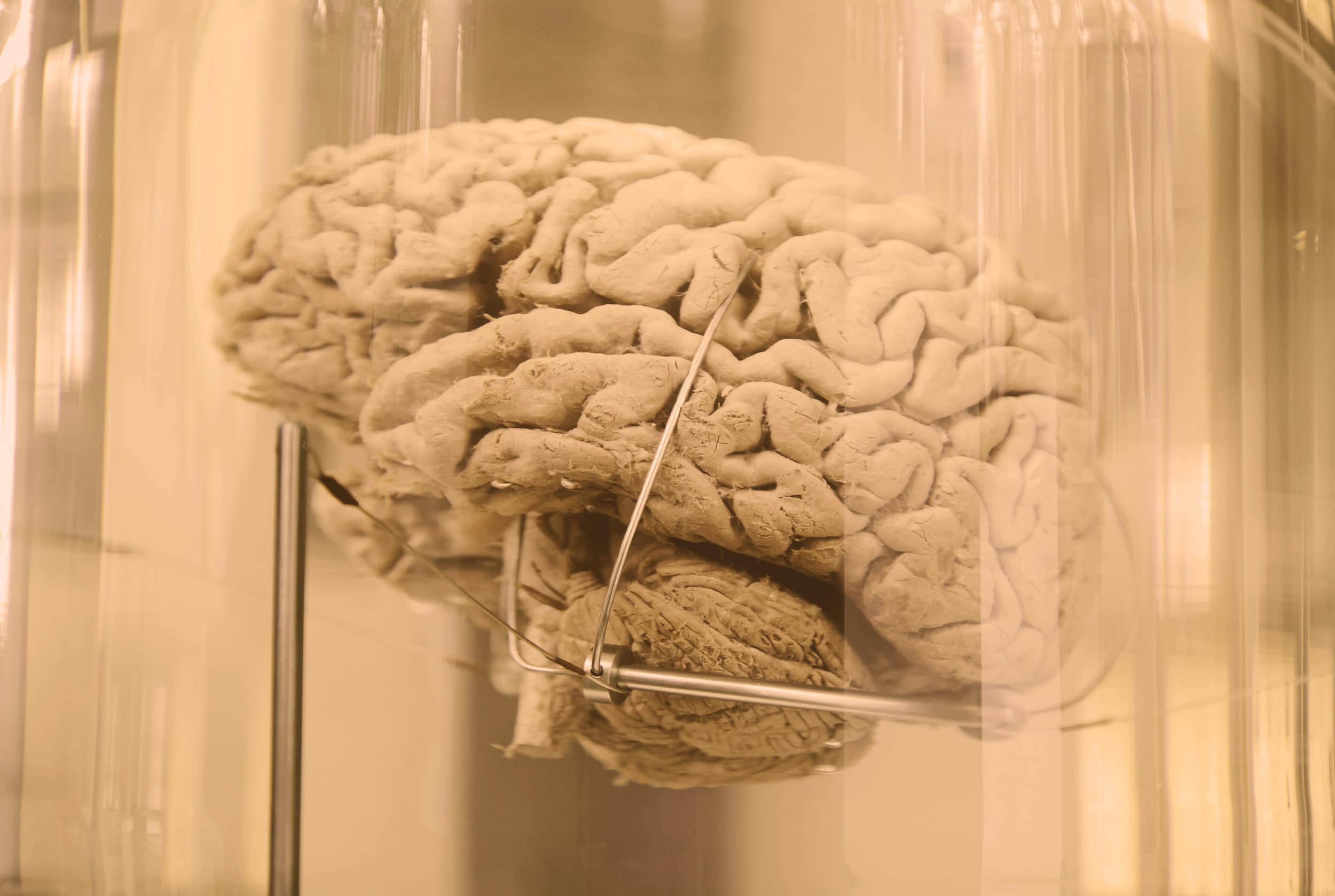 Cerveau humain préservé