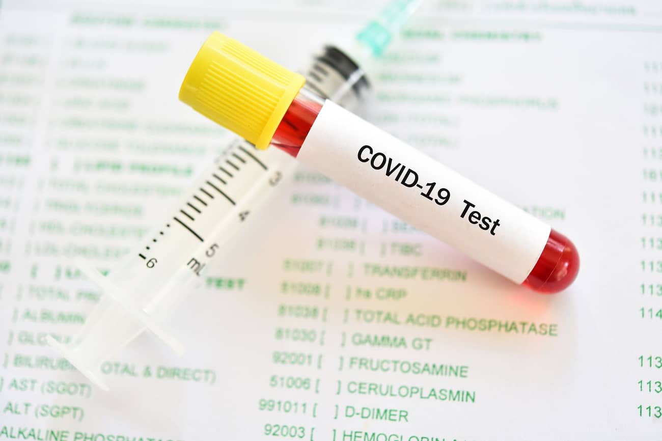 Covid-19 : une faille de sécurité a falsifié les résultats d’un test à domicile très répandu