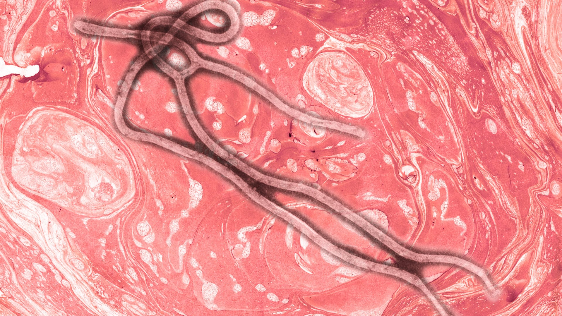Le virus Ebola