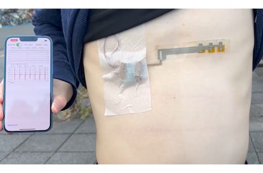 Des scientifiques développent des capteurs cardiaques flexibles comme des kirigamis