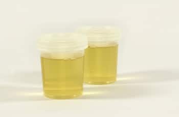 Échantillons d'urine